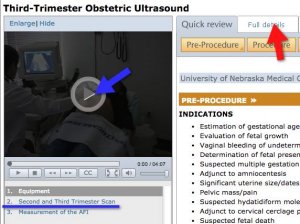 screenshot of ProceduresConsult third trimester obstetric ultrasound window with arrow pointing to Full Details