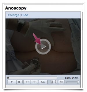 A screenshot of the video thumbnail/start scree.